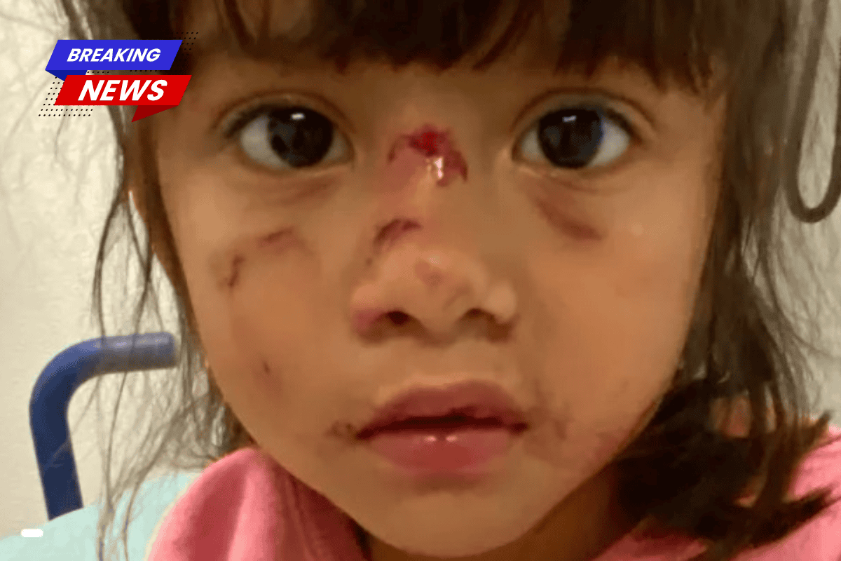 A three-year-old girl lost teeth and had bite marks on her face after a man attacked her while she was fishing in Texas Park